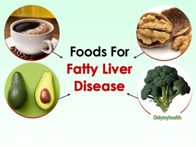 What is good diet for fatty liver